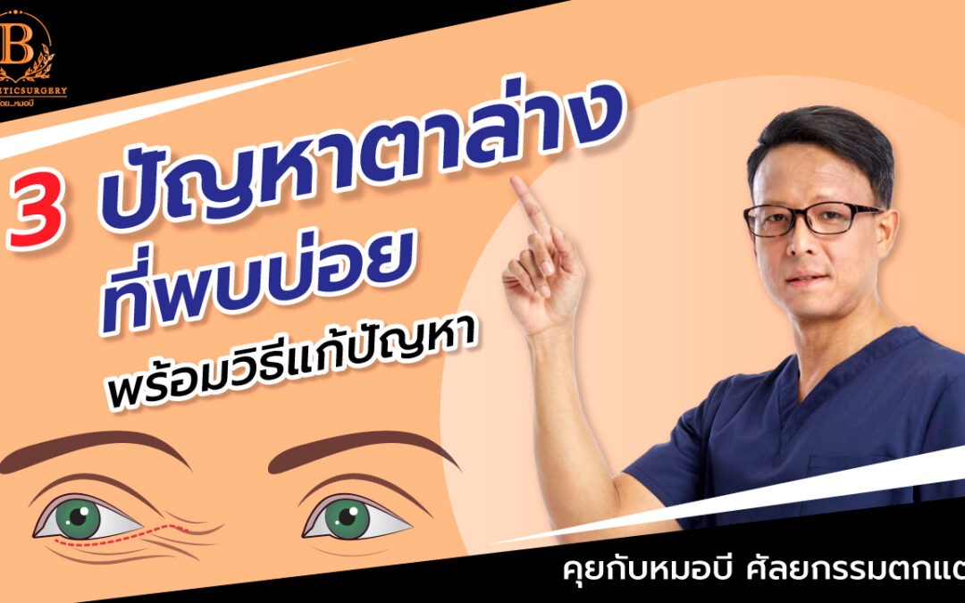 3 ปัญหาตาล่างที่พบบ่อย และทางแก้