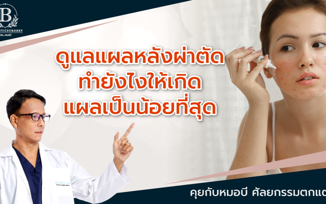 ดูแลแผลผ่าตัดหลังศัลยกรรม ทำยังไงให้เกิดแผลเป็นน้อยที่สุด