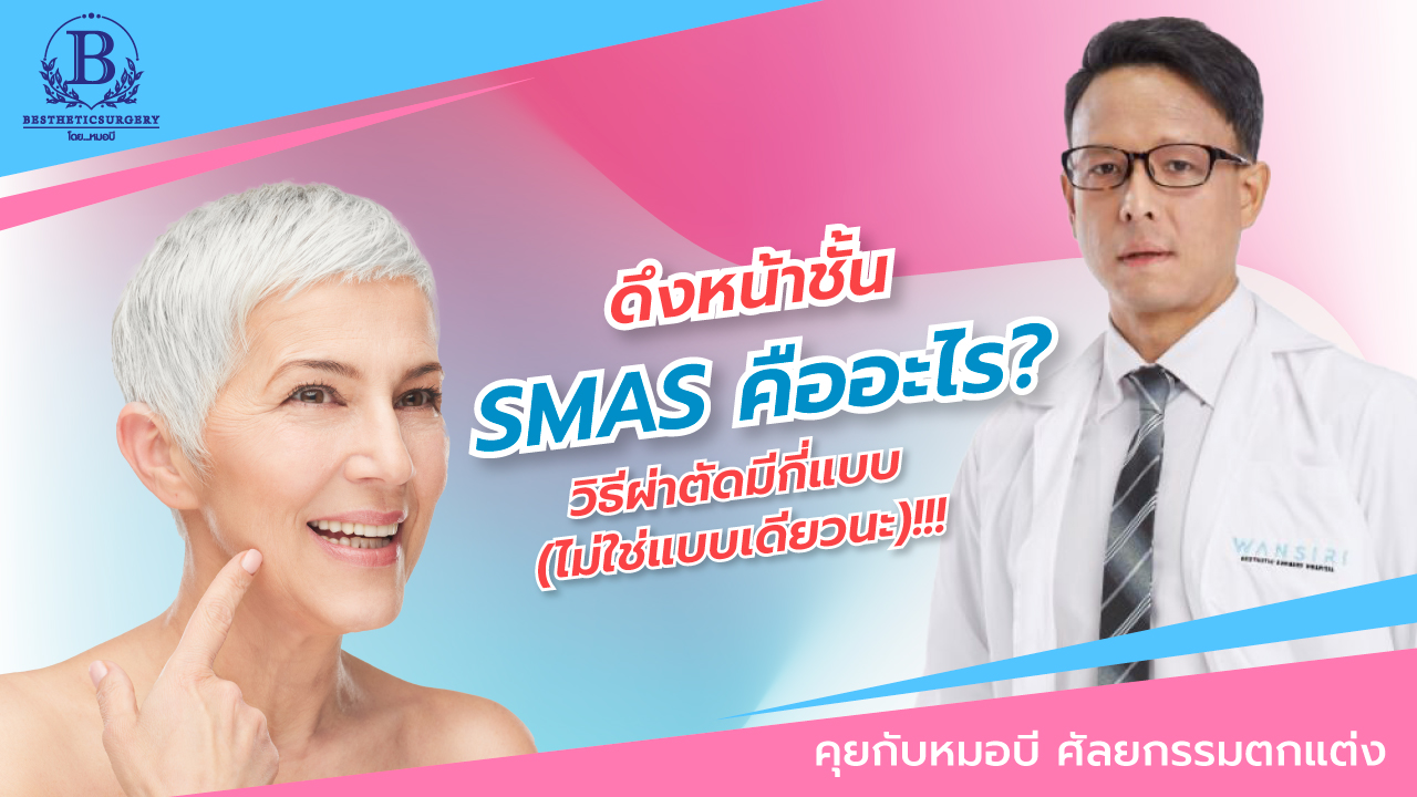ดึงหน้าชั้น SMAS คืออะไร มีวิธีผ่าตัดอะไรบ้าง?