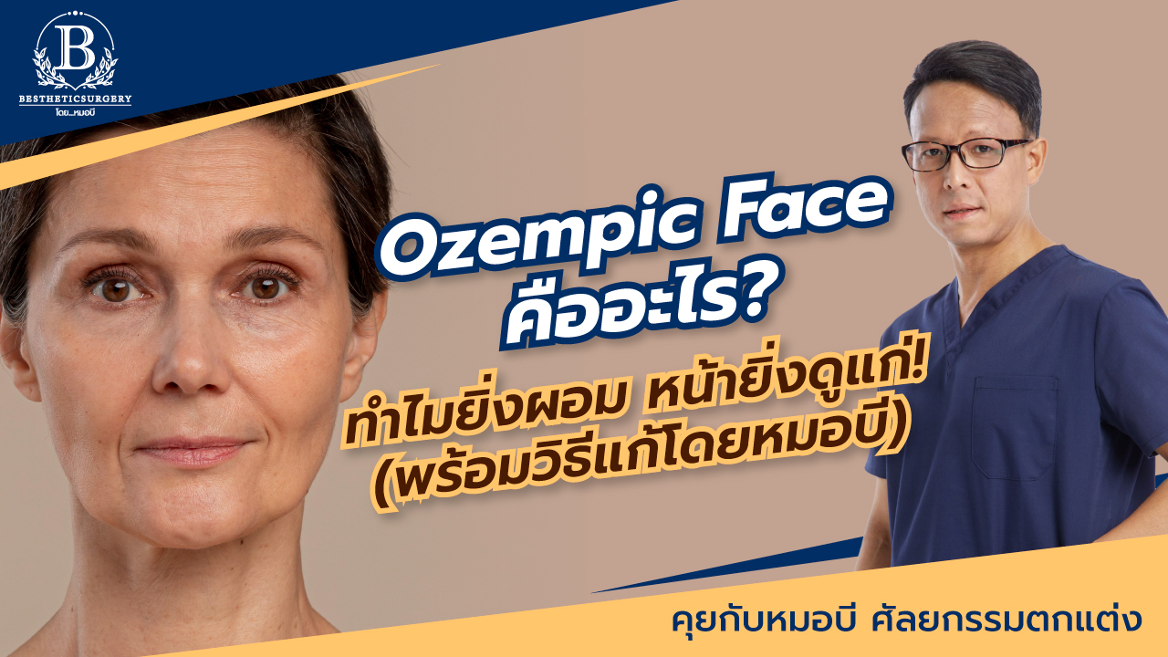 Ozempic Face หน้าตอบ แก้มย้อย หลังใช้ปากกาลดน้ำหนัก แก้ไขด้วยการดึงหน้าและฉีดไขมันได้จริงหรือ?